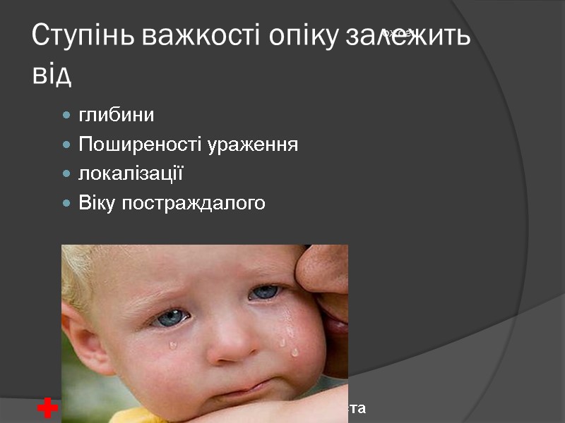 Ступінь важкості опіку залежить від глибини Поширеності ураження локалізації Віку постраждалого